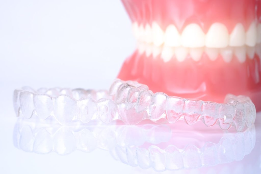 Do clear aligners work? And how? Shine Fellows